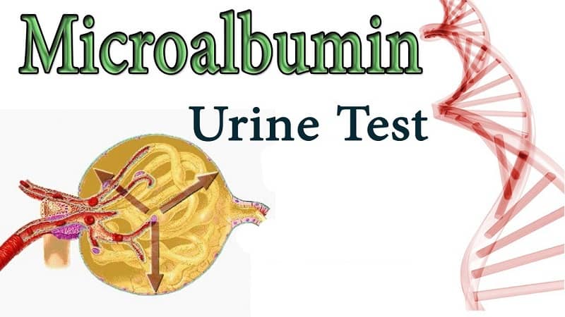 Administer Urine Microalbumin Test