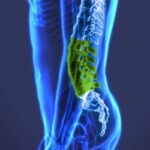 Spinal Implants