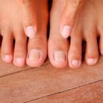 One Cup of This Will Destroy Your Nail Fungus